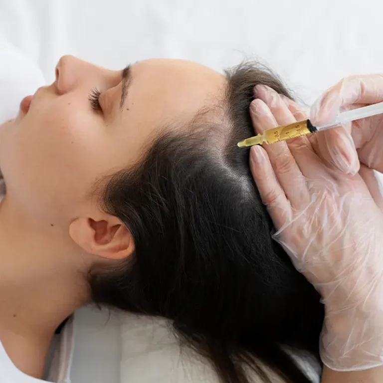 Hair Mesotherapy